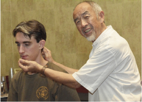 acupuncturefromliding color Sitting in a chair receiving acupuncture needles in face and head.